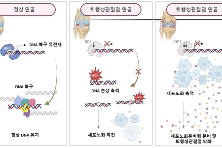 평소 무릎관절 소중히 해야 하는 이유 있다. 국내 연구진 연골보호 단백질 발견