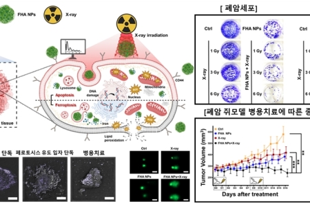 페로토시스 유도 나노입자와 X선 조사를 활용한 효과적인 복합 항암치료 가능성 규명