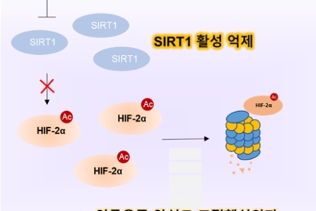 난치성 육종암 환자 숙원 치료전략 실마리, 핵심 대사표적 국내 연구진이 찾았다