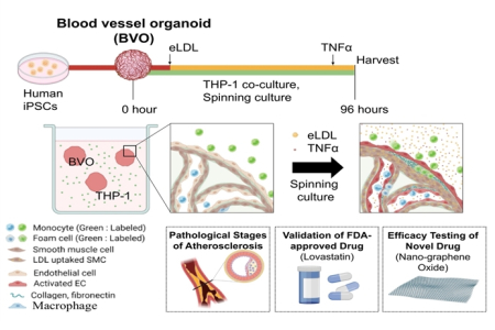 인간 혈관 오가노이드를 이용하여 처음으로 동맥경화증 모델링 및 약물평가법 제시