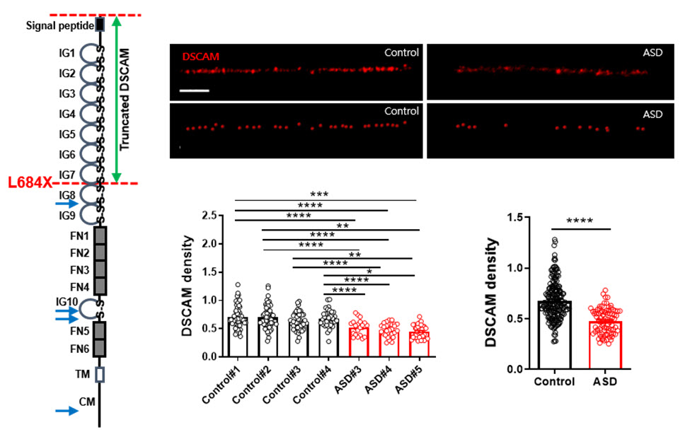 (왼쪽) 자폐증 환자에게서 발견된 <i>DSCAM</i> 유전자 돌연변이의 위치와 그로 인해 잘리는 부분을 각각 빨간색과 파란색 화살표로로 표시하였다.<br>(오른쪽 위) 정상 신경세포와 환자 유래 신경세포의 신경돌기에서 DSCAM의 발현을 나타낸 예시 이미지.<br>(오른쪽 아래) 오른쪽 위의 이미지를 정량화하여 분석한 데이터. 환자 유래 신경세포에서 DSCAM의 밀도가 더 적음을 확인하였다.