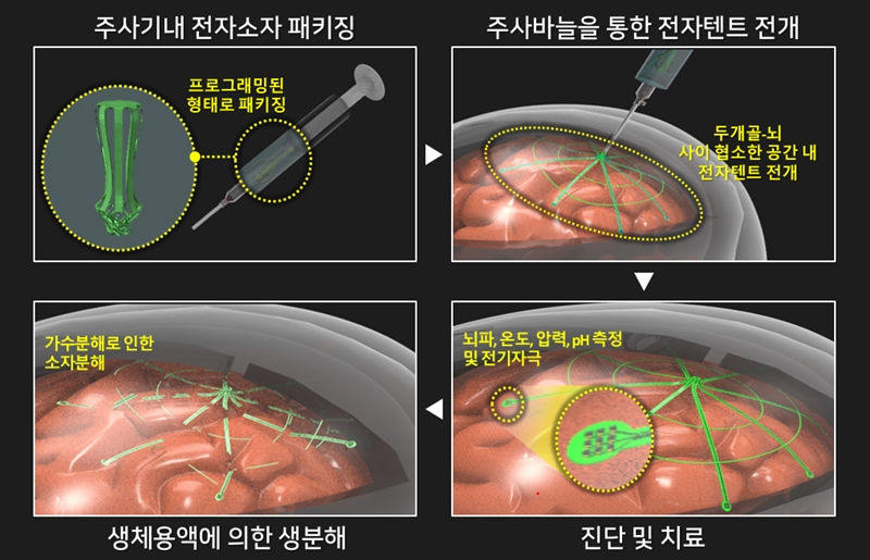 ▲ (그림1) 생분해성 전자 텐트를 활용한 최소침습적 대면적 뇌 표면전극 삽입 과정