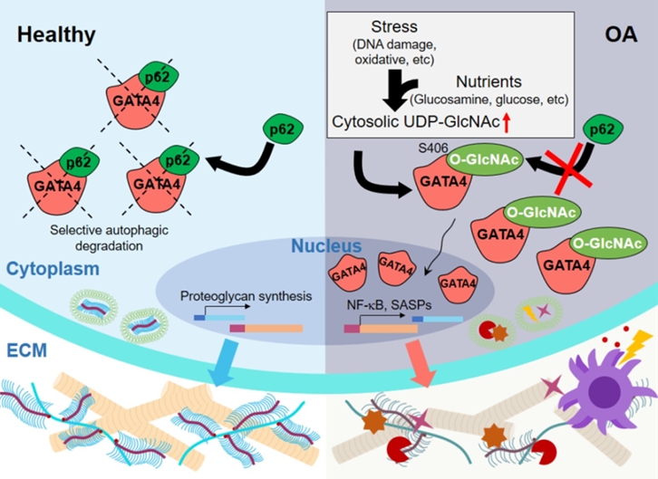 연골세포 내 UDP-GlcNAc 대사와 O-GlcNAc 당 수식화에 의해 노화 연관 염증반응과 퇴행성관절염이 심화되는 기전