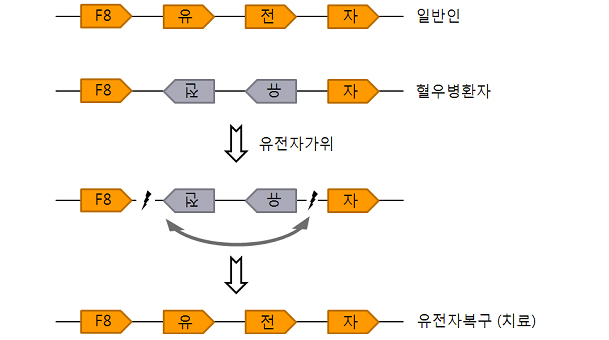 [그림1] 혈우병 유전자 교정. 혈액응고인자 유전자를 편의상 F8, 유, 전, 자, 네 부분으로 구성되었다고 가정하자. 중증 혈우병 환자 상당수는 이 유전자의 일부가 뒤집어져 있어 정상적인 혈액응고인자 단백질을 만들지 못해 혈우병이 발생한다. 유전자가위를 이용하면 뒤집어진 부위를 잘라내어 원상복구 시킬 수 있다.